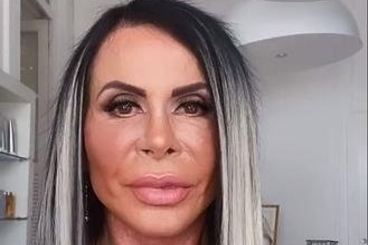 Após críticas, Gretchen mostra como realmente ficou sua harmonização facial