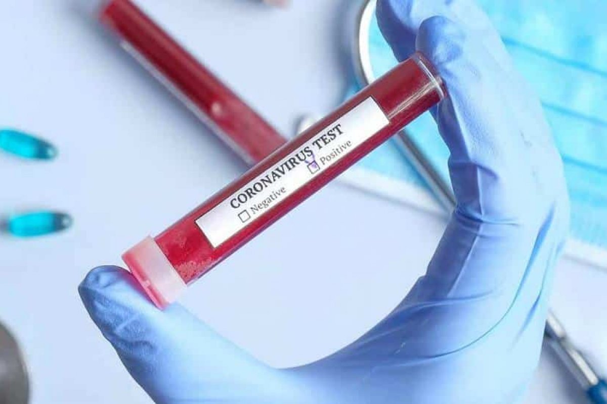 Em todo mundo, apenas 15 países ainda não registraram casos de Covid-19