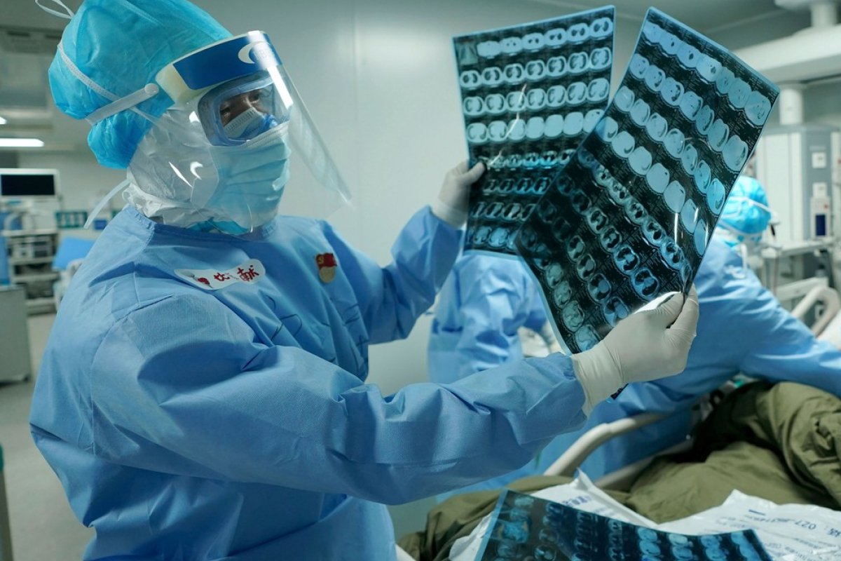 Maioria dos pacientes com Covid-19 tem ao menos um sintoma seis meses depois da internação