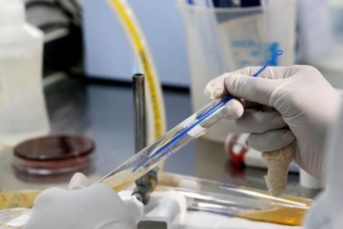 Bahia já possui 11 casos de superfungo resistente a medicamentos