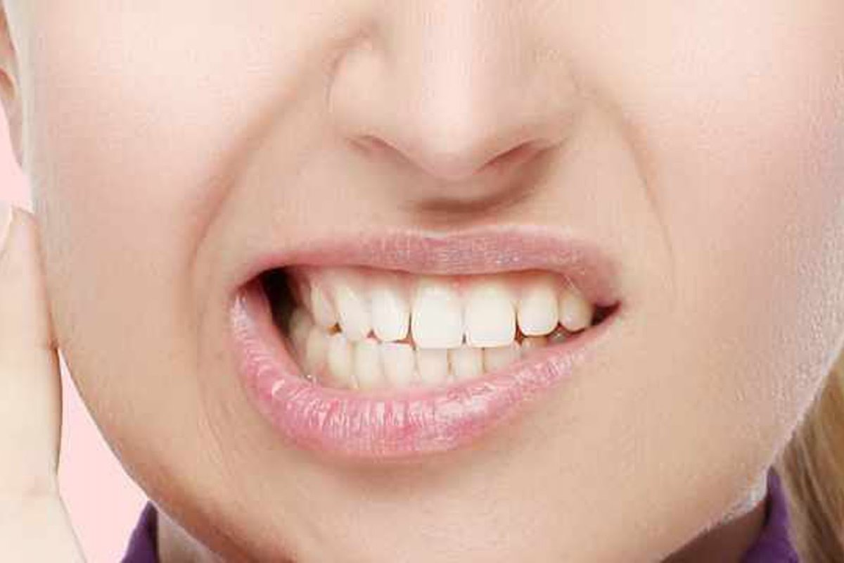 Bruxismo afeta 40% da população brasileira