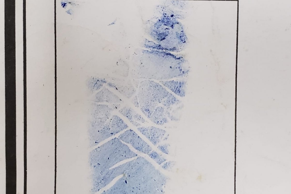 Peritos identificam corpo através das plantas dos pés