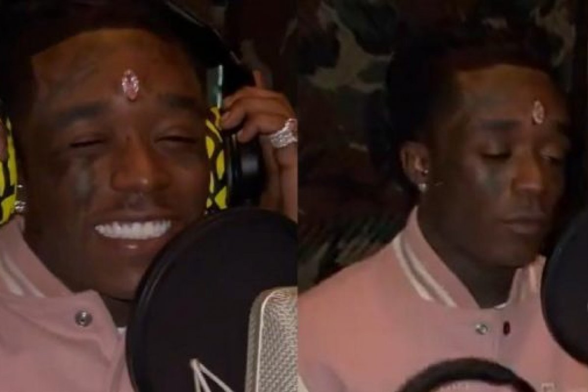 Famoso implanta diamante rosa de R$ 128 milhões na testa