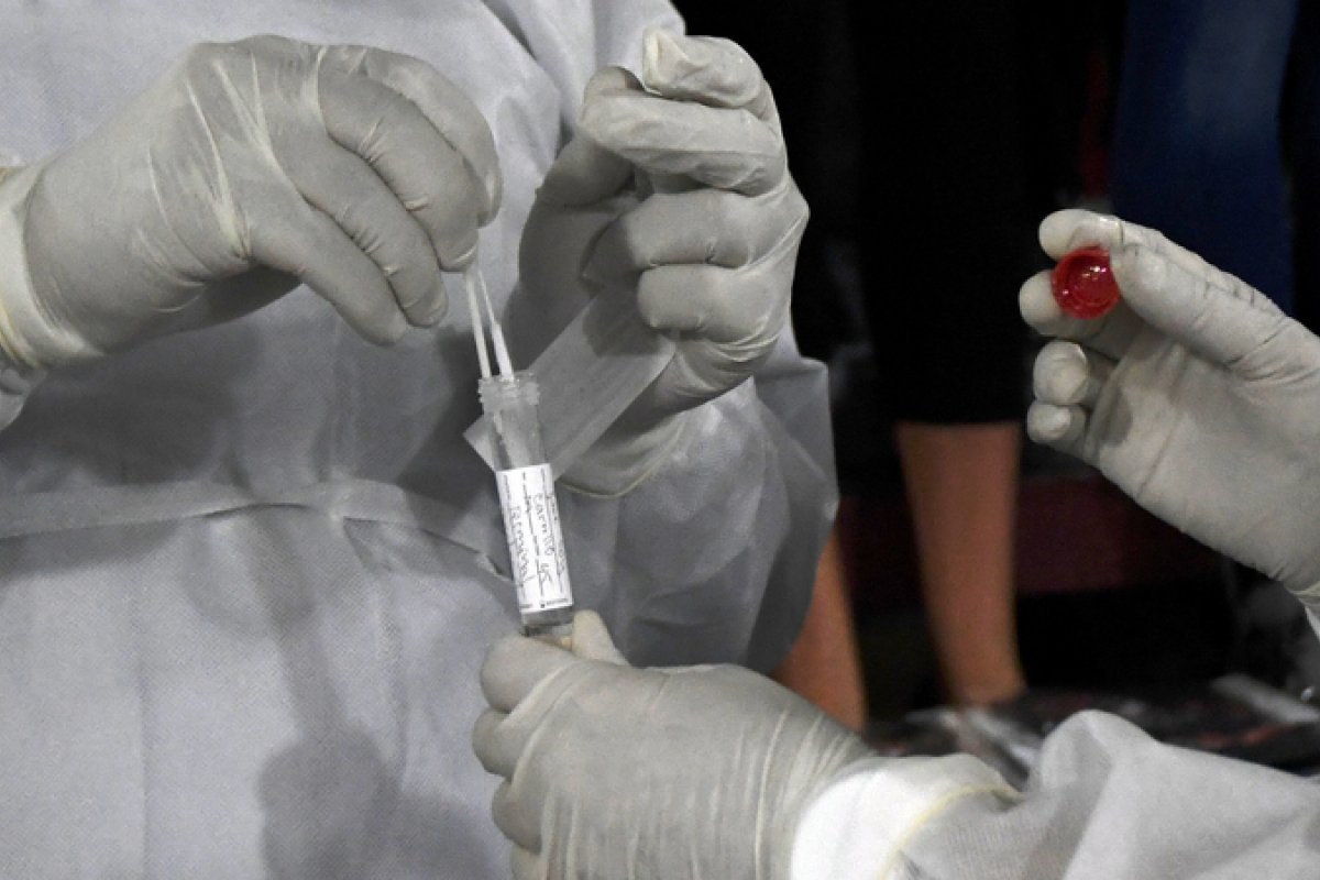 Tocilizumabe é eficaz na redução de mortes entre internados com Covid-19 grave