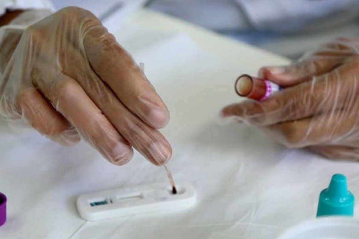 Unidades de saúde de Salvador disponibilizam testes rápidos para detecção de DSTs