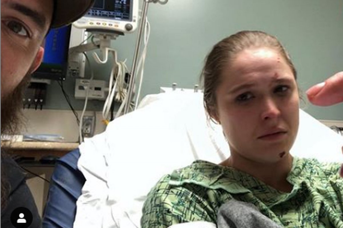 Ronda Rousey sofre grave acidente em filmagens; imagens fortes