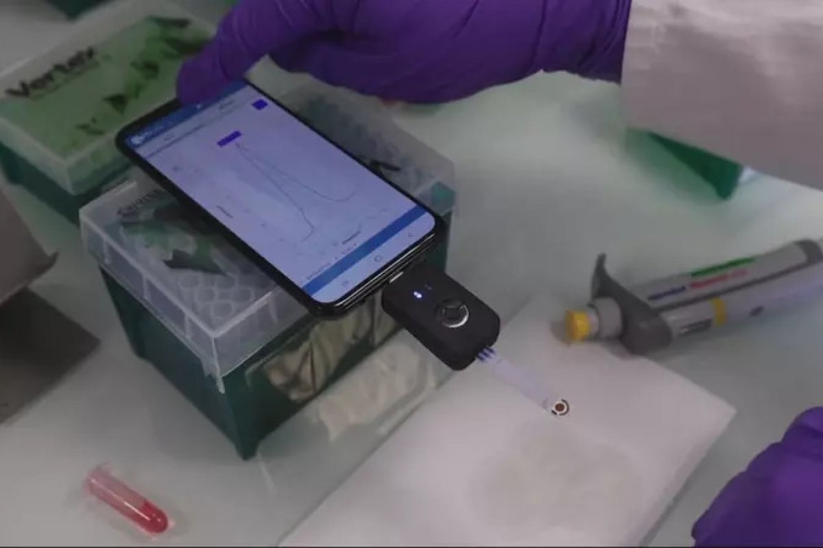 Pesquisadores elaboram teste rápido para detectar Covid-19 pelo smartphone