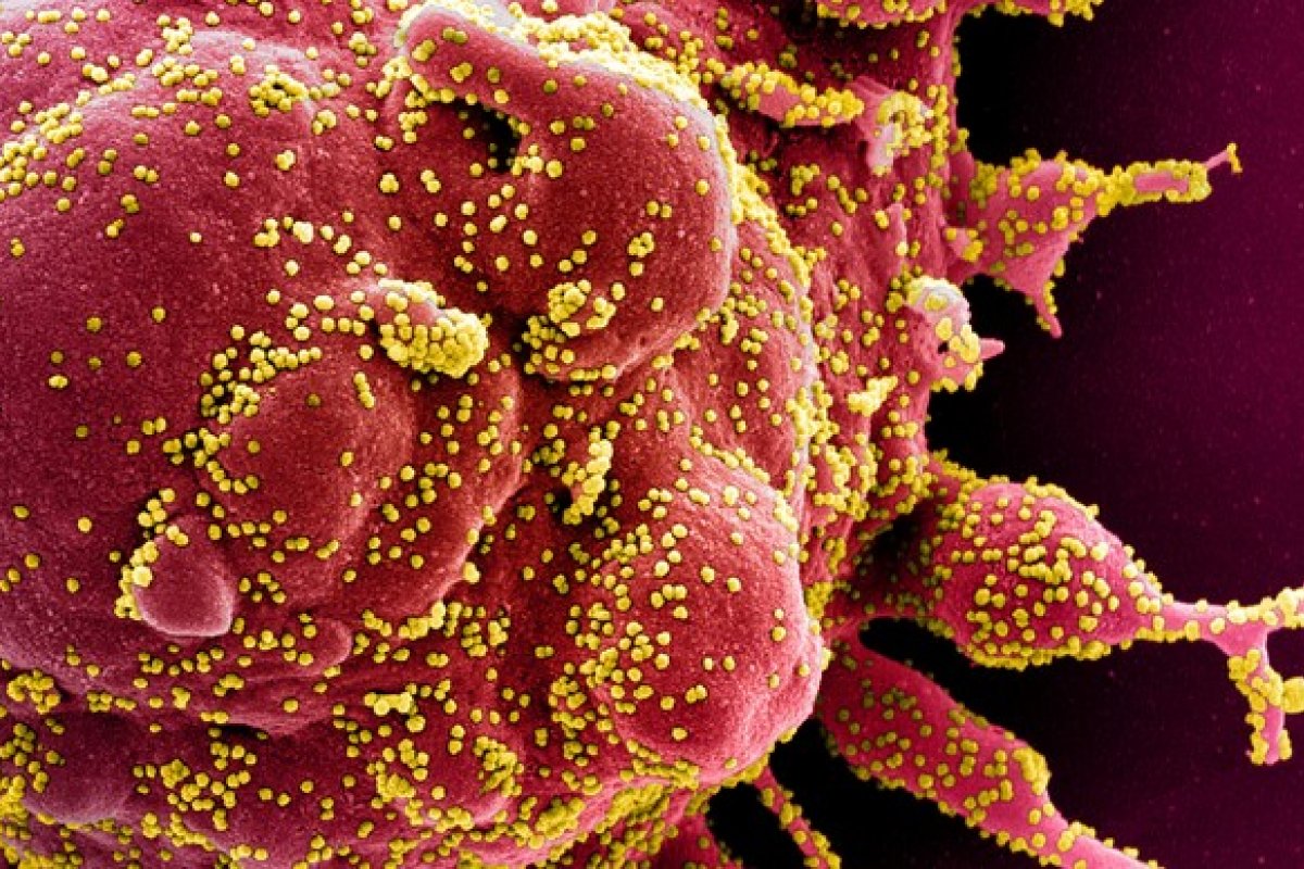 MPF investiga contrato de R$ 144 milhões feita pelo Ministério da Saúde