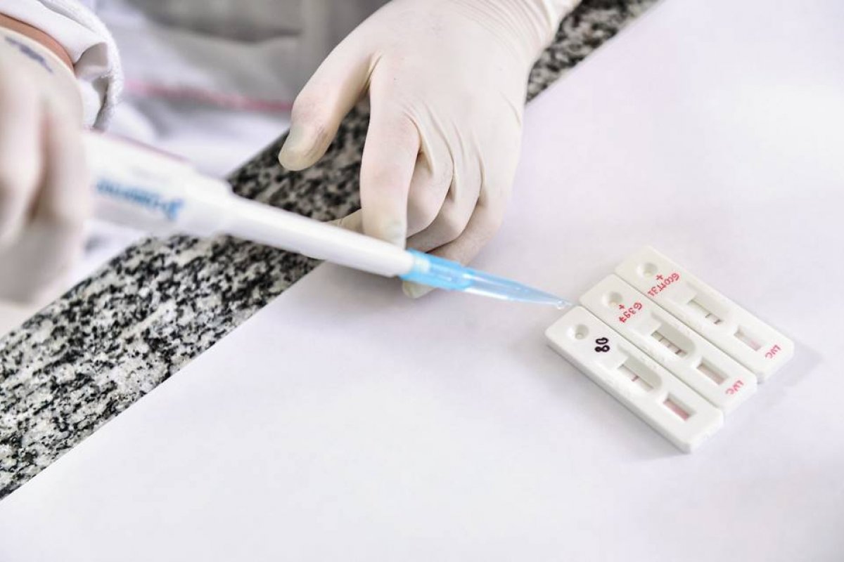 Fiocruz desenvolve teste rápido para diagnosticar novas cepas do coronavírus