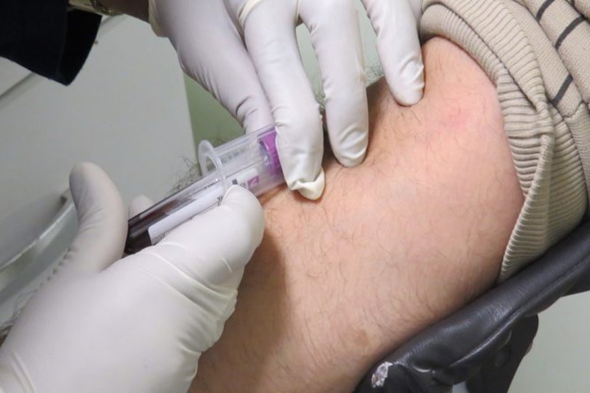 Número de doadores de medula óssea cai para 60% na Bahia