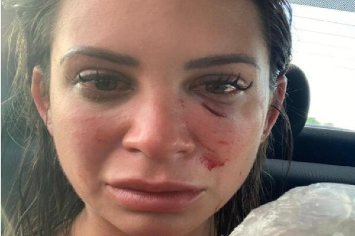 Quatro pessoas acusam empresário de agressão em resort de luxo na Bahia