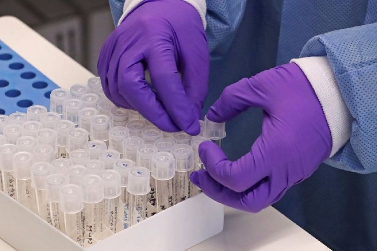 Prefeitura de Salvador amplia postos com testes para detecção da Covid-19