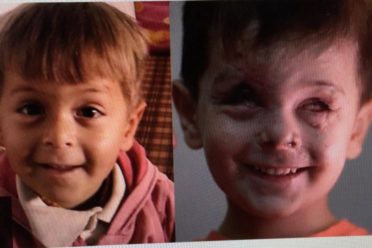 BBC divulga foto de menino Sirio multilado e retrata o horror da guerra no país