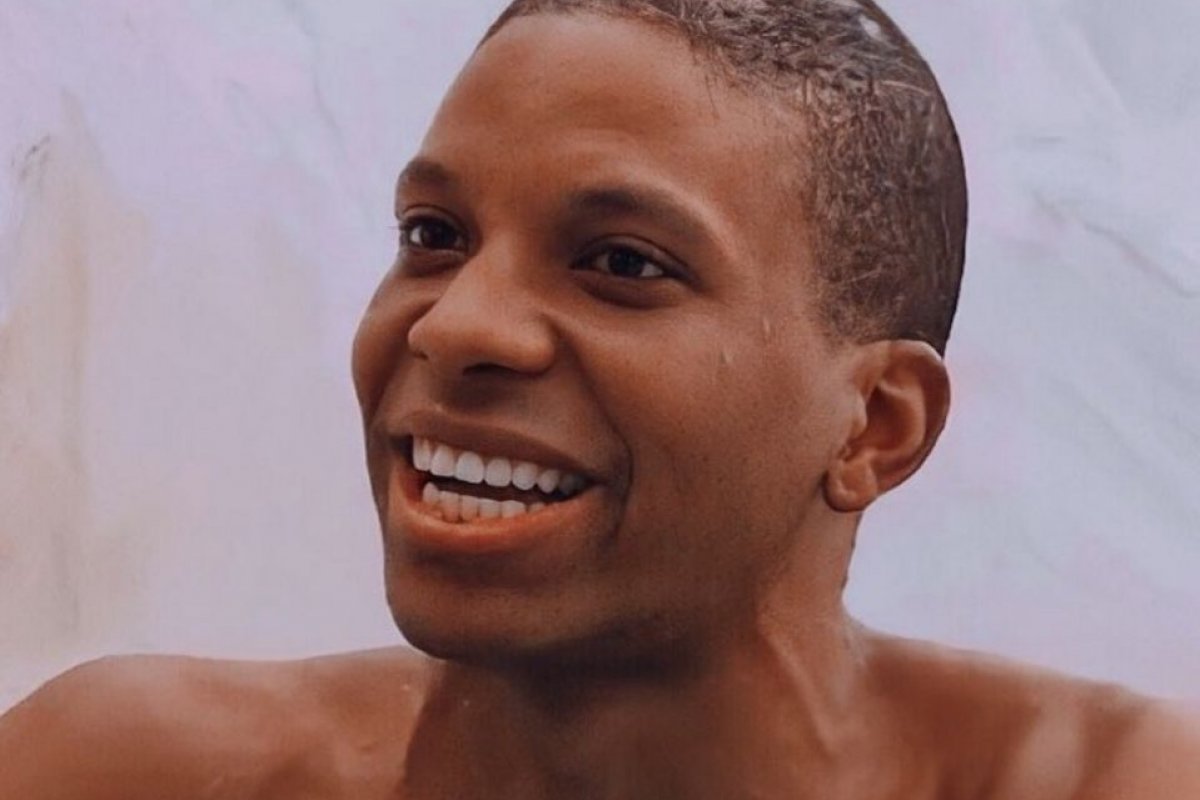 Falhas no cabelo? Ex-BBB chama atenção para problemas capilares