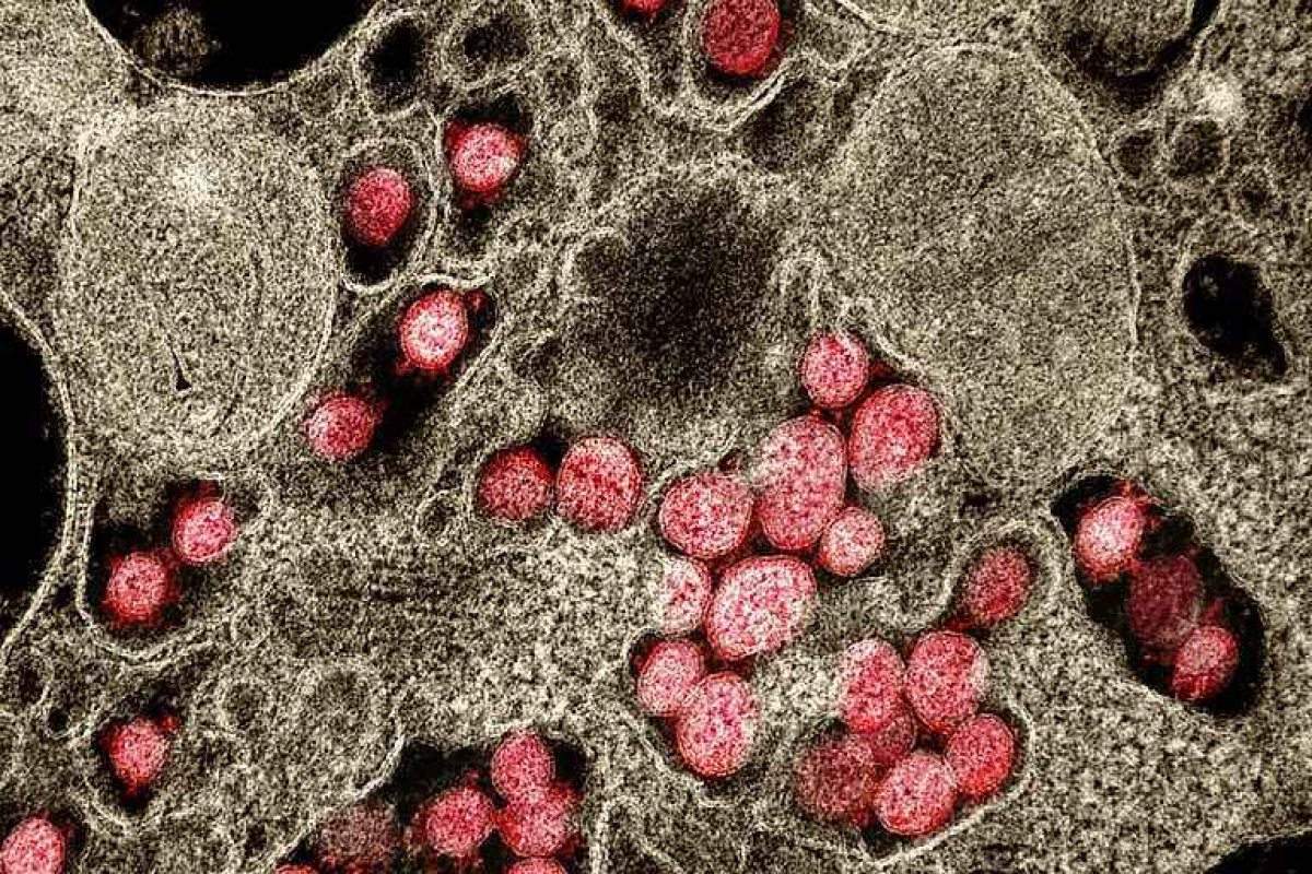 Mutação de variante brasileira está em maioria dos casos em seis estados