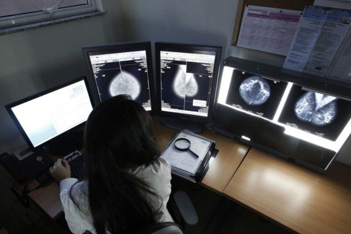 Diagnósticos de câncer reduzem no Brasil durante pandemia