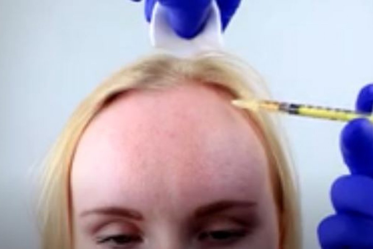 Especialista se destaca por falar sobre doenças raras da dermatologia na TV