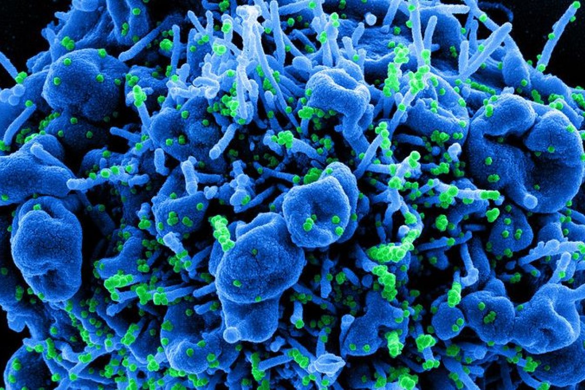 Pesquisadores descobrem nova variante da covid-19 em circulação no Brasil