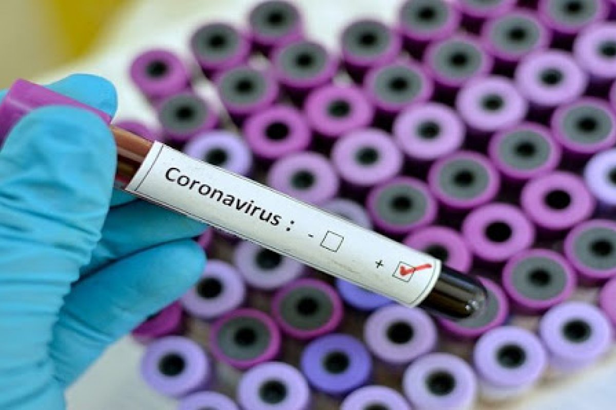 Peru diz que variante brasileira é responsável por 40% das infecções em Lima