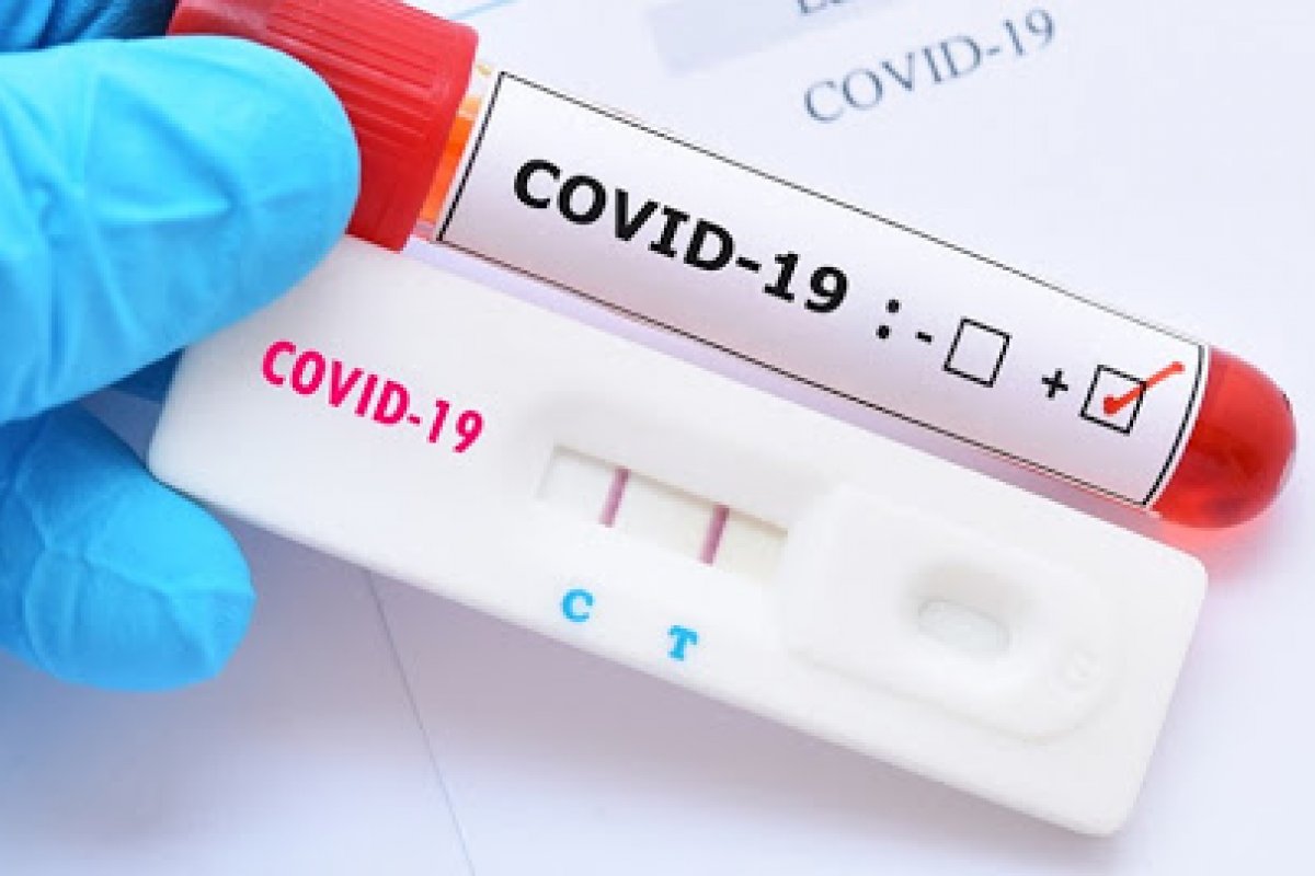Covid-19: Brasil registra mais 100 mil casos e 2,7 mil mortes em 24h