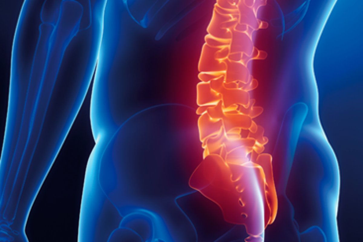 Nova técnica de cirurgia minimamente invasiva da coluna lombar é realizada pelo abdômen e acelera recuperação!