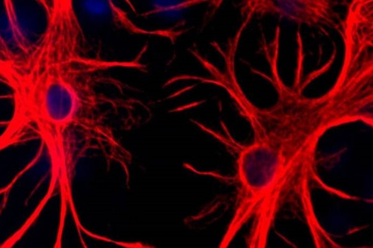 Pesquisa revela presença de 'genes zumbis' em cérebro humano