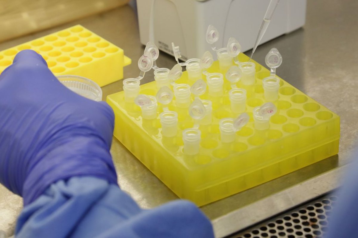 Pesquisadores indicam avanço nos testes para desenvolver vacina contra HIV