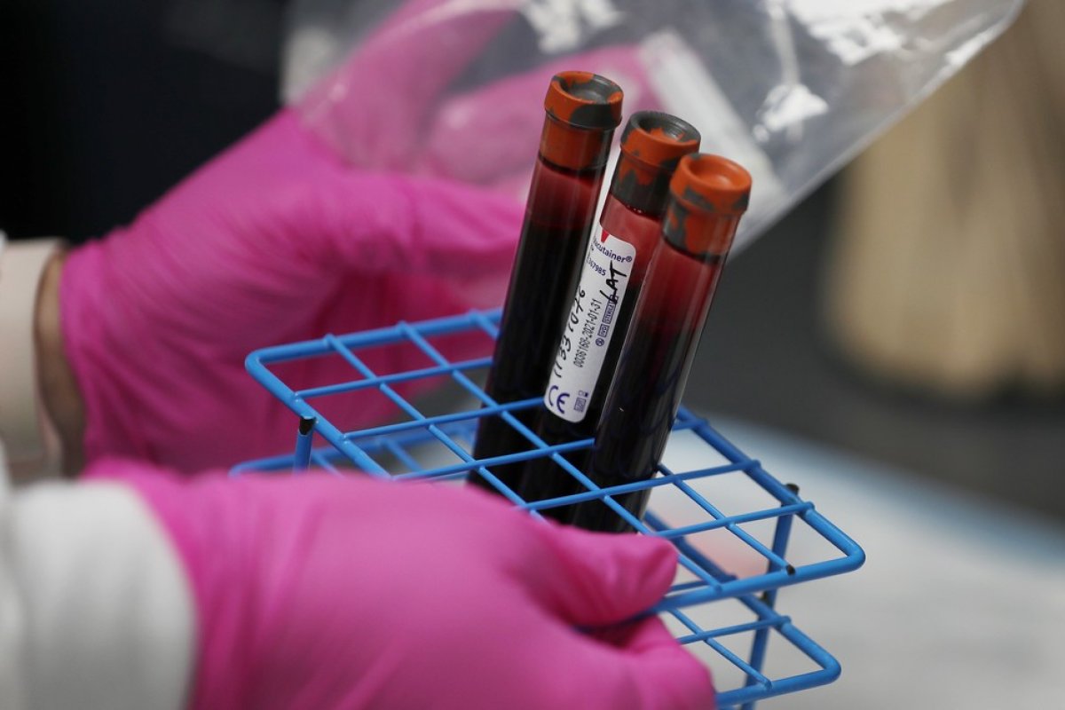 Novo estudo descarta elo entre tipo sanguíneo e a incidência de Covid