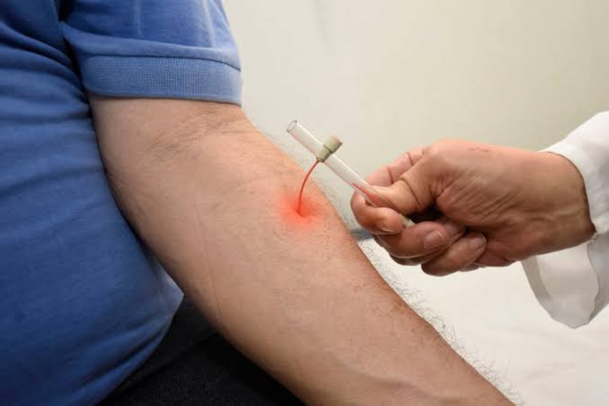 Live debate diminuição de diagnóstico de hanseníase no país