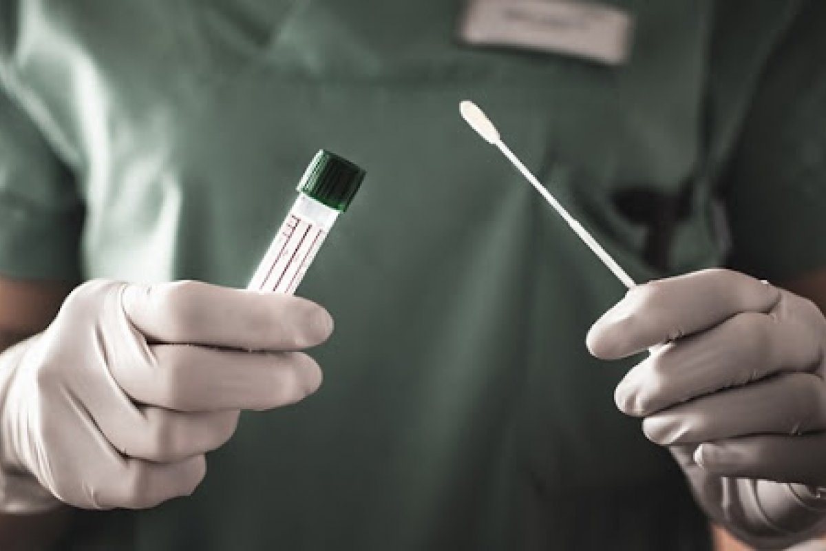 TCU quer que Ministério da Saúde dê explicações sobre 2 milhões de testes de Covid parados em galpão de SP