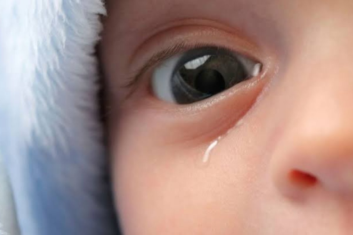 Obstrução do canal lacrimal afeta 6% dos recém-nascidos