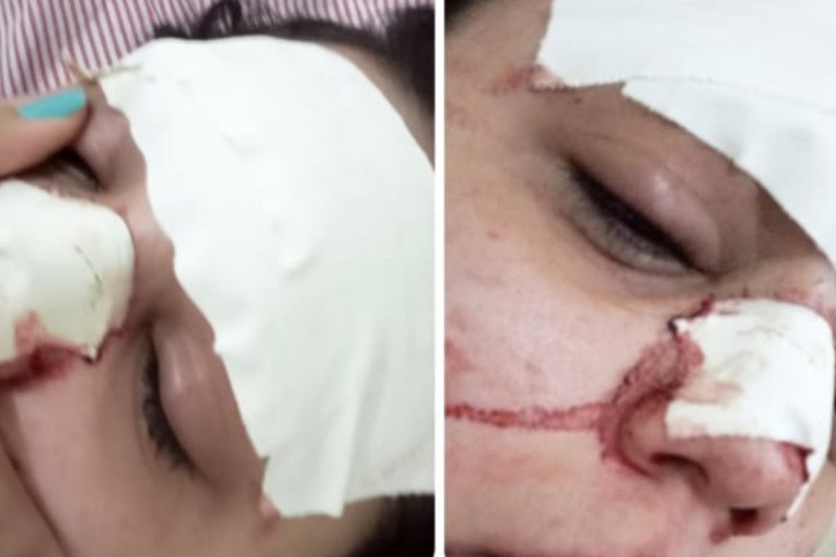 Jovem de 22 anos é agredida em Barra da Estiva, na Bahia