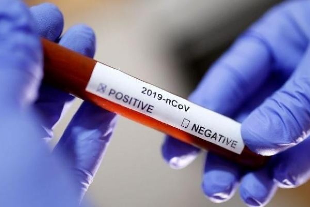 Mortes por Covid-19 tiveram 35% de queda nos 10 primeiros dias de maio