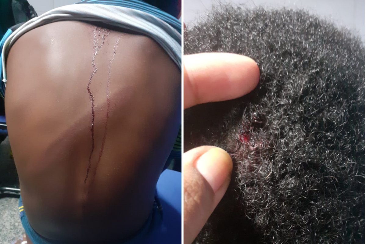 Criança de 12 anos é espancada por segurança no Subúrbio de Salvador