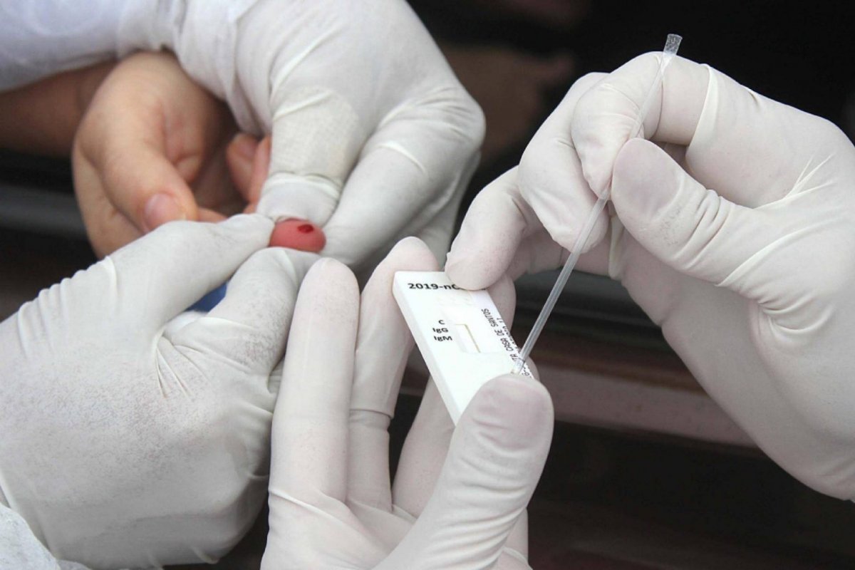 Saúde diz que vai enviar 600 mil testes para o Maranhão contra variante indiana