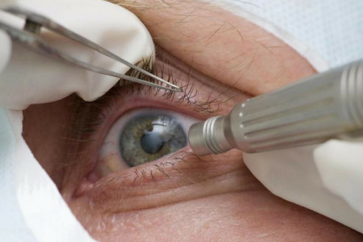 Combate ao glaucoma
