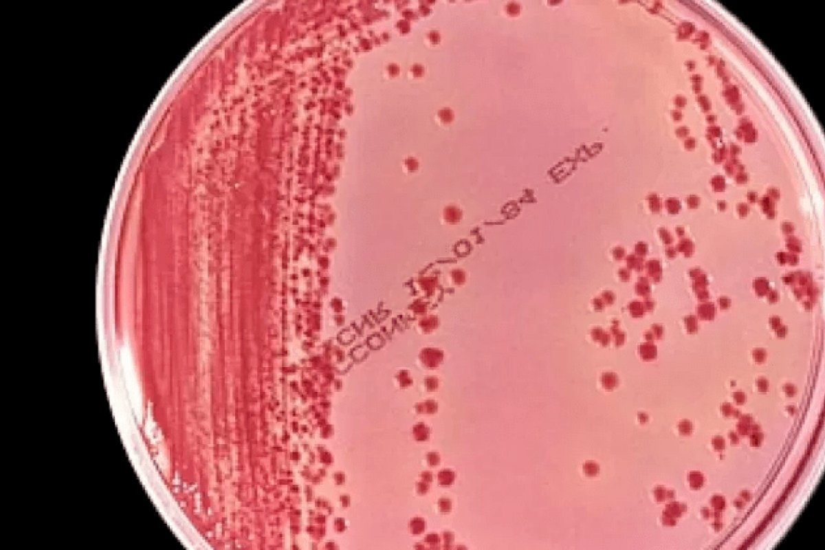 Brasil usa poucos testes para detecção do coronavírus