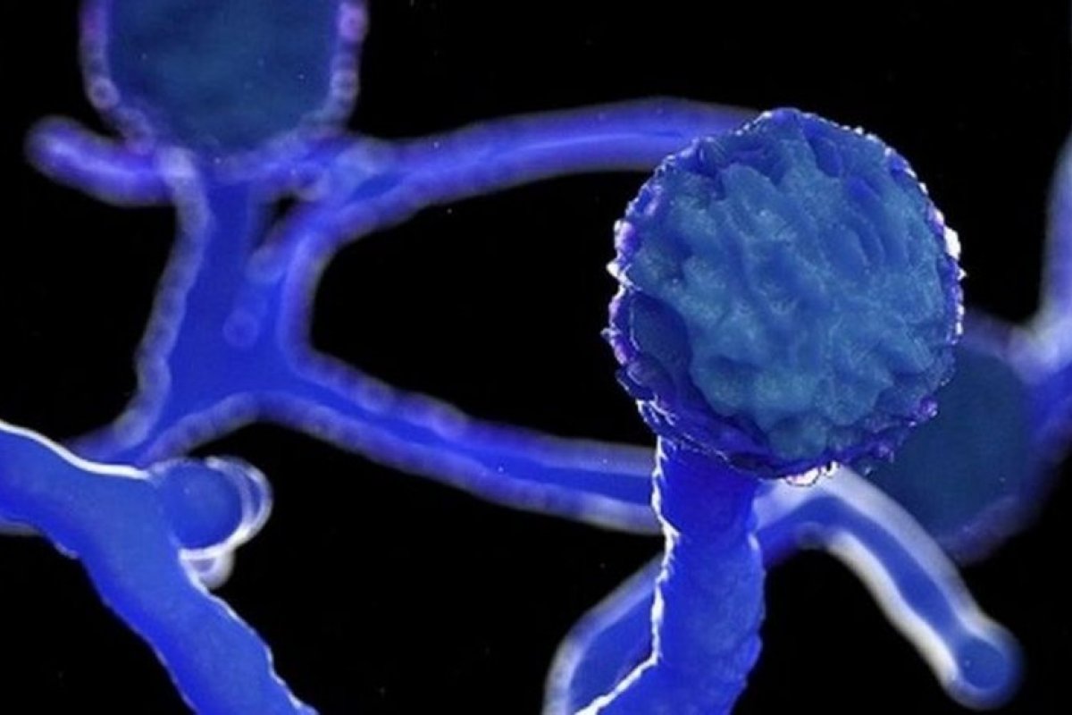 Secretaria de Saúde do Pará confirma primeiro caso de mucormicose associado à Covid-19