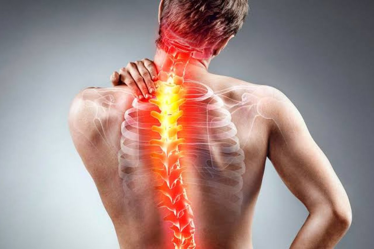 Junho Verde: Escoliose é tema de campanha internacional