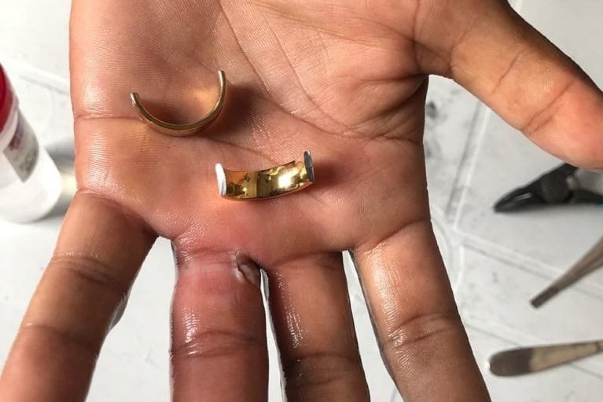 Homem é socorrido por bombeiros após ficar com aliança presa no dedo