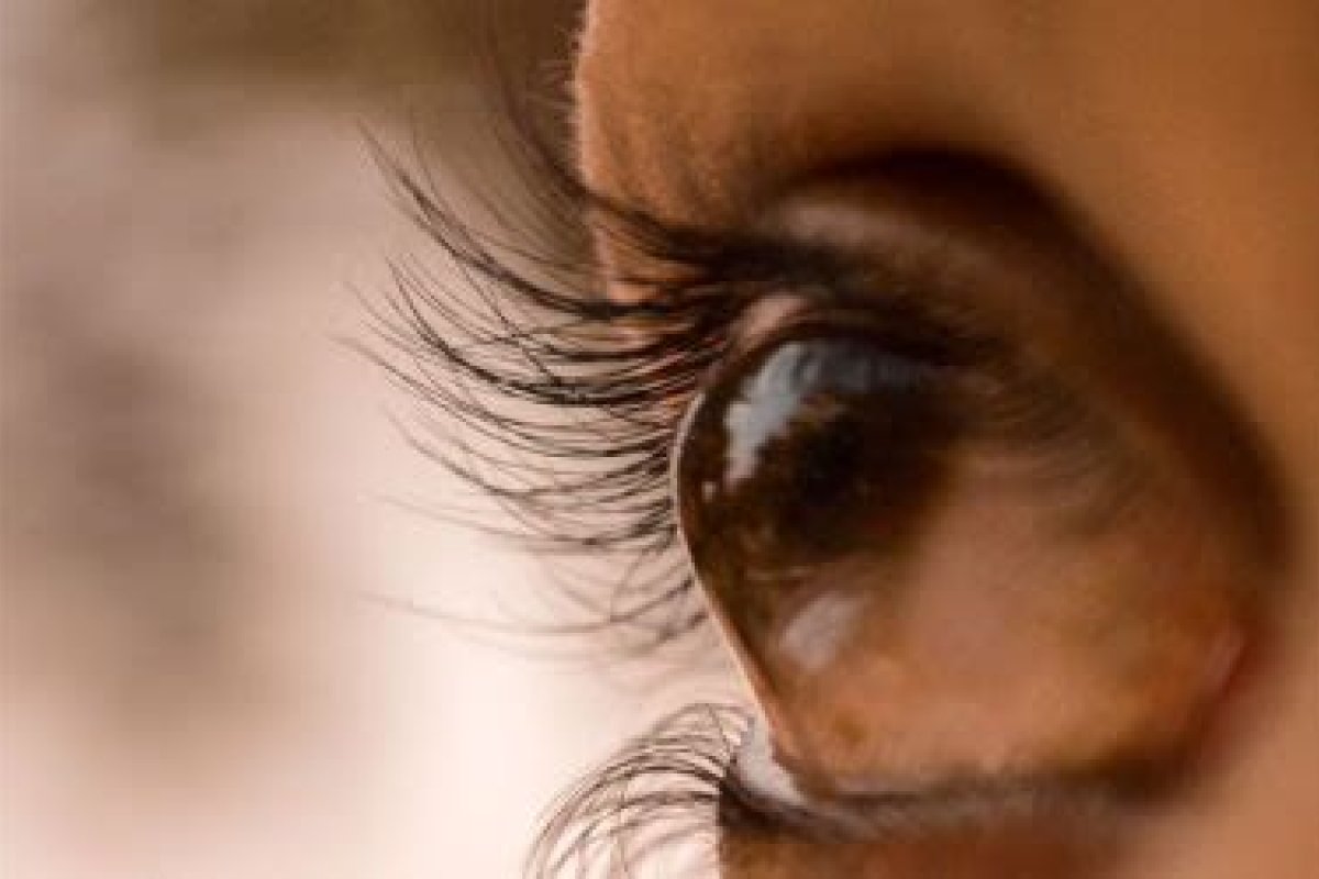 Ceratocone: cerca de 150 mil brasileiros convivem com o problema na visão