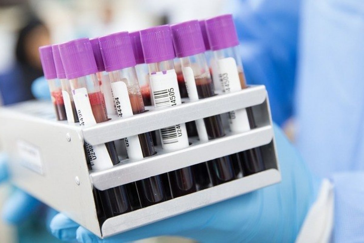 Exame de sangue promete detectar mais de 50 tipos de câncer