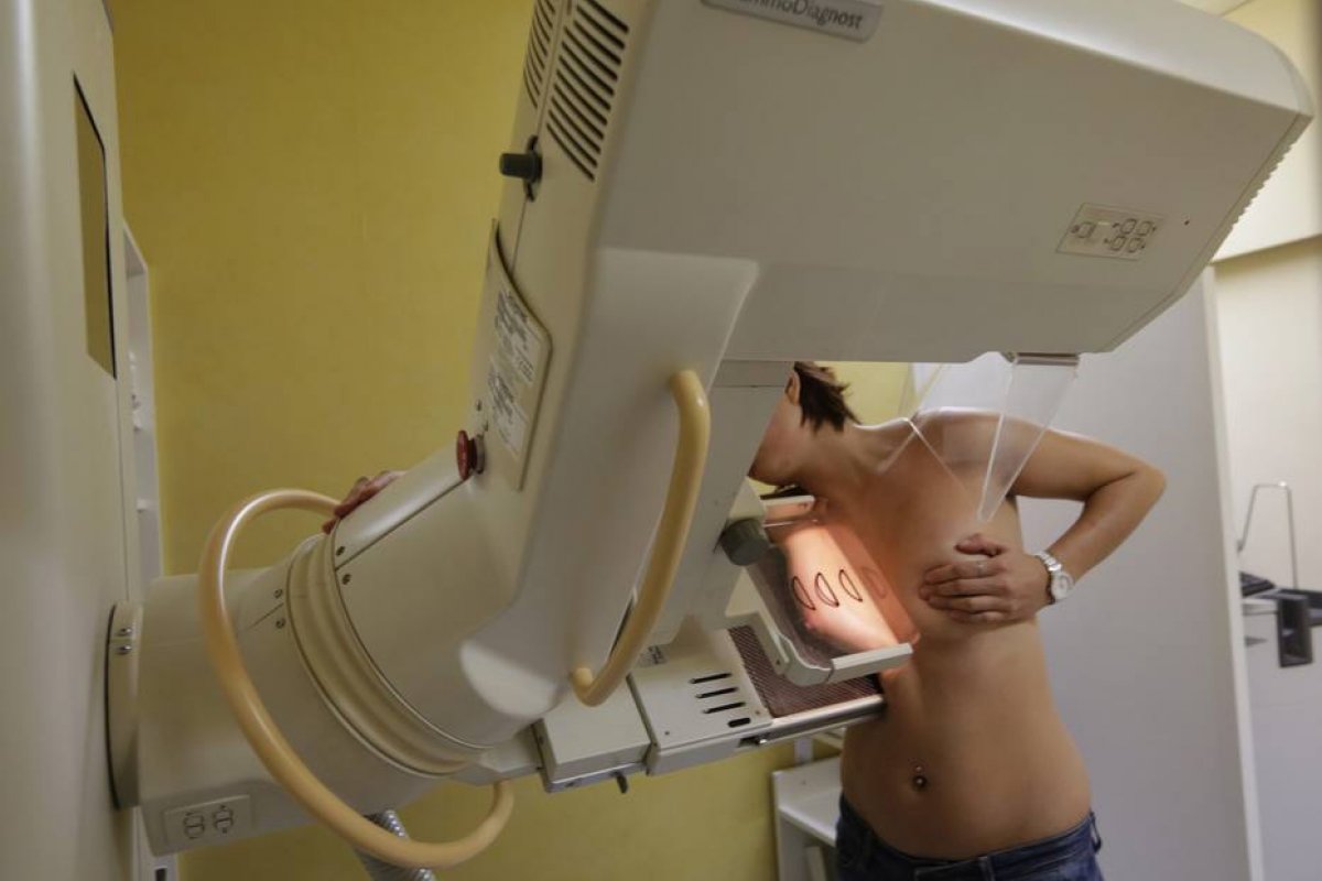 Mulheres devem esperar 4 semanas após vacina contra covid para fazer mamografia de rotina, diz SBM