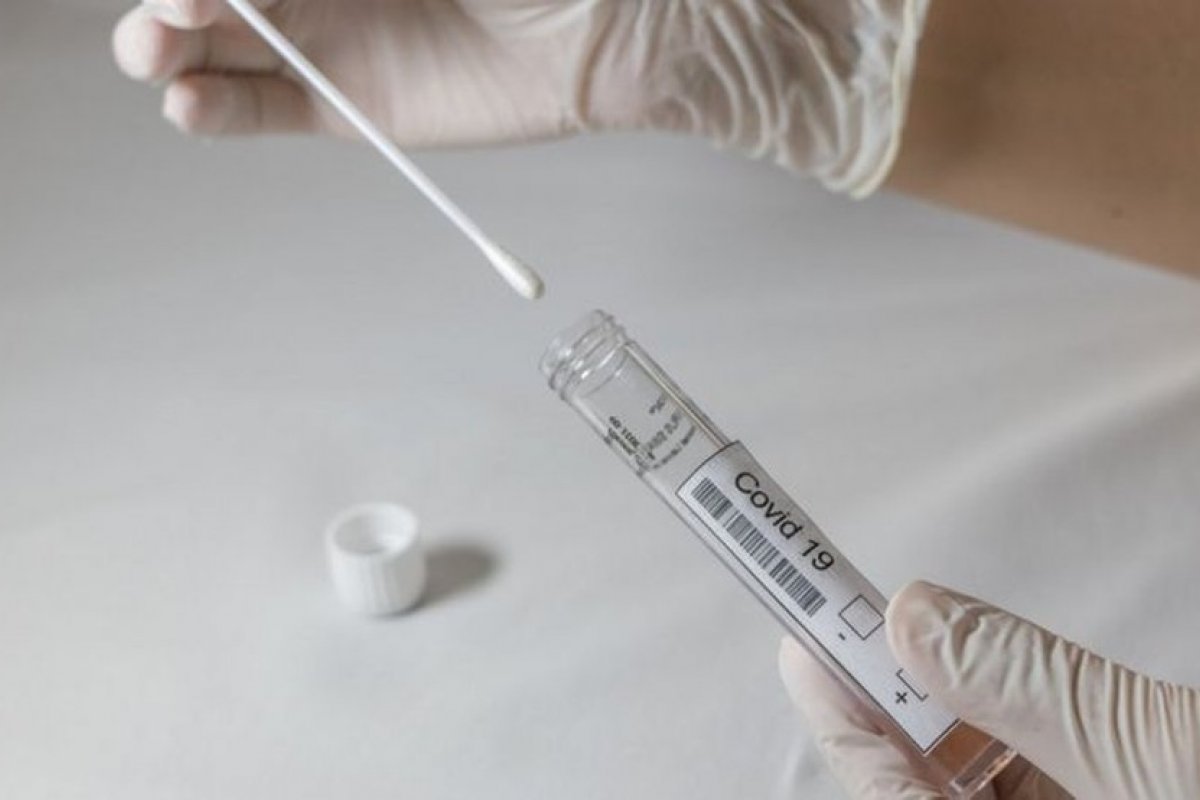 Brasil registra 20 casos da variante Delta, com duas mortes somadas