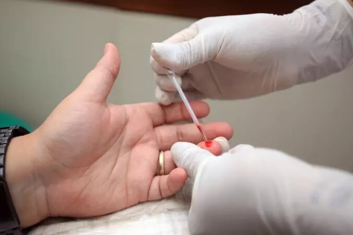 "Nunca estivemos tão perto de uma vacina contra o HIV", diz pesquisador do Estudo Mosaico