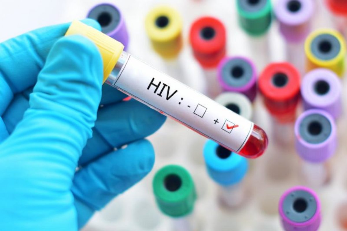 HIV: pesquisa detalha distribuição dos subtipos no Brasil