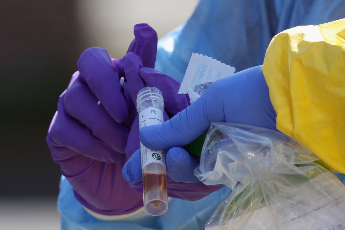 Anvisa autoriza estudos clínicos sobre 3° dose da vacina AstraZeneca e uso da proxalutamida para tratamento da Covid-19