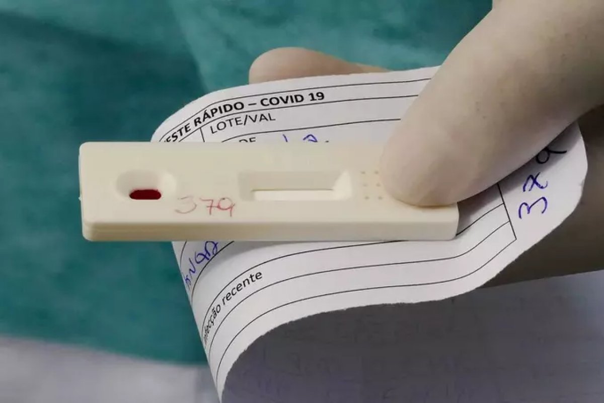 OMS e empresa brasileira produzirão 4 milhões de testes Covid
