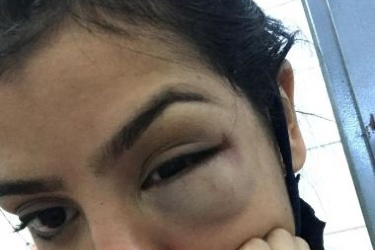 Jovem denuncia policial após sofrer agressão durante evento em Porto Seguro