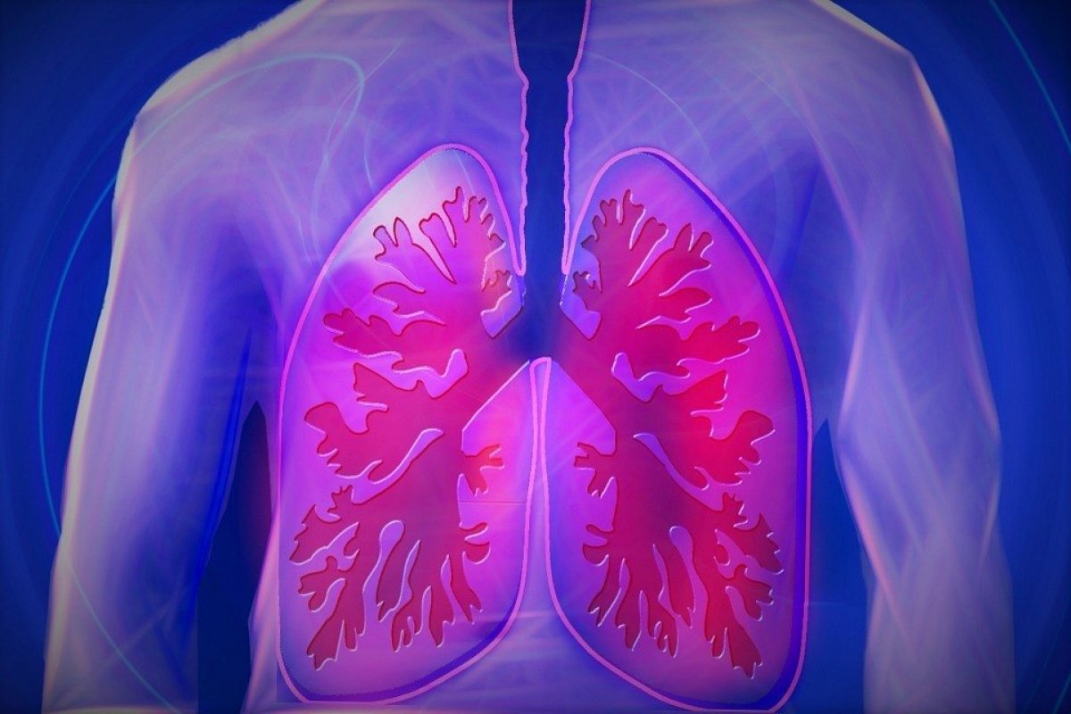 Mais de 3,5 milhões podem apresentar fibrose pulmonar pós-covid